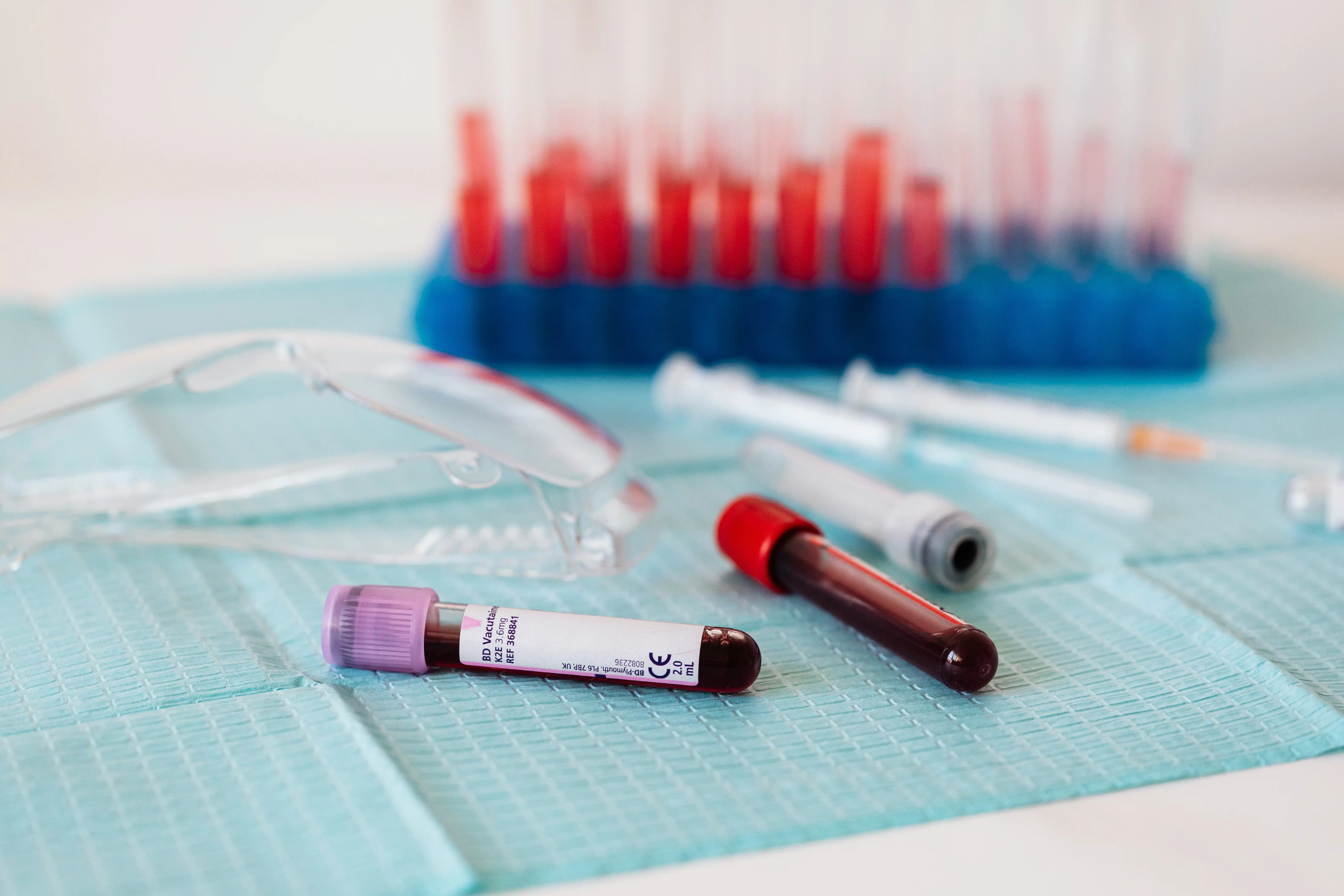 blood test vials.